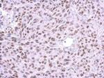 HMGB1 Antibody in Immunohistochemistry (Paraffin) (IHC (P))