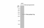 Strep Tag Antibody in Western Blot (WB)