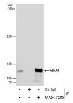 ADAR Antibody in Immunoprecipitation (IP)