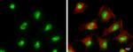 ADAR Antibody in Immunocytochemistry (ICC/IF)