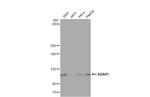 ADAR Antibody in Western Blot (WB)