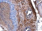 TAGLN Antibody in Immunohistochemistry (Paraffin) (IHC (P))