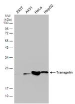 TAGLN Antibody in Western Blot (WB)