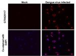 Dengue Virus Type 2 Envelope Antibody in Immunocytochemistry (ICC/IF)