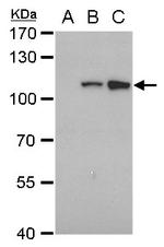 Dengue Virus Type 2 NS5 Antibody in Western Blot (WB)