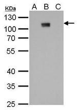 Dengue Virus Type 2 NS5 Antibody in Western Blot (WB)