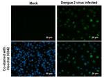 Dengue Virus Type 2 NS5 Antibody in Immunocytochemistry (ICC/IF)