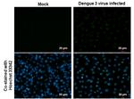 Dengue Virus Type 2 NS5 Antibody in Immunocytochemistry (ICC/IF)