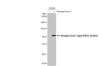 Dengue Virus Type 2 NS5 Antibody in Western Blot (WB)