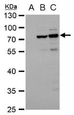 Dengue Virus Type 2 NS3 Antibody in Western Blot (WB)