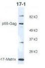 HIV1 p17 Antibody in Western Blot (WB)