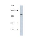 NCAPD3 Antibody in Western Blot (WB)