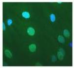 Nesprin 1 Antibody in Immunocytochemistry (ICC/IF)