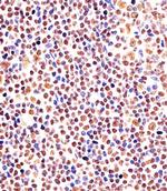 EZH2 Antibody in Immunohistochemistry (Paraffin) (IHC (P))