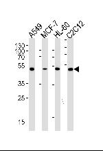 AVPR1A Antibody in Western Blot (WB)