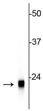 VSNL1 Antibody in Western Blot (WB)