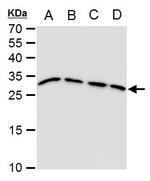 TPI1 Antibody in Western Blot (WB)