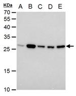 TPI1 Antibody in Western Blot (WB)