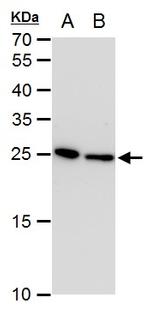 TPI1 Antibody in Western Blot (WB)