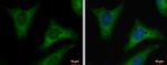 TPI1 Antibody in Immunocytochemistry (ICC/IF)