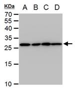 TPI1 Antibody in Western Blot (WB)