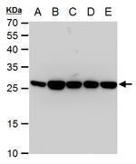 TPI1 Antibody in Western Blot (WB)