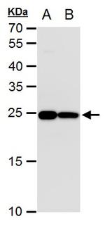 TPI1 Antibody in Western Blot (WB)