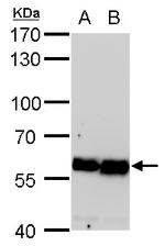 COPD Antibody in Western Blot (WB)