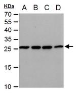 TPI1 Antibody in Western Blot (WB)