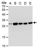 TPI1 Antibody in Western Blot (WB)