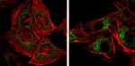 CALCOCO2 Antibody in Immunocytochemistry (ICC/IF)