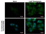 CALCOCO2 Antibody in Immunocytochemistry (ICC/IF)