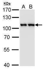 CAS Antibody in Western Blot (WB)