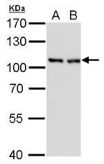 CAS Antibody in Western Blot (WB)