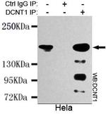 Dynactin 1 Antibody in Immunoprecipitation (IP)