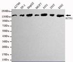 Dynactin 1 Antibody in Western Blot (WB)