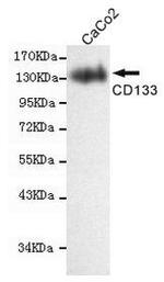 CD133 Antibody in Western Blot (WB)