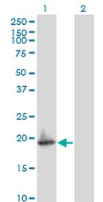 ARF5 Antibody in Western Blot (WB)