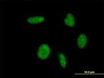 ATOH1 Antibody in Immunocytochemistry (ICC/IF)