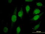 ATRX Antibody in Immunocytochemistry (ICC/IF)