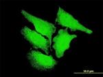 CaMKII delta Antibody in Immunocytochemistry (ICC/IF)