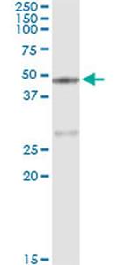 Carboxypeptidase A1 Antibody in Immunoprecipitation (IP)