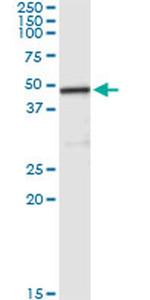 Carboxypeptidase A2 Antibody in Immunoprecipitation (IP)