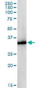 GPD1 Antibody in Western Blot (WB)