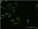 Hex Antibody in Immunocytochemistry (ICC/IF)