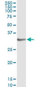 HOXA1/HOXB1/HOXD1 Antibody in Immunoprecipitation (IP)