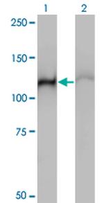 HSPA4 Antibody in Western Blot (WB)