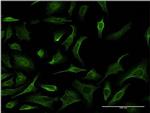 PHKG2 Antibody in Immunocytochemistry (ICC/IF)