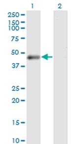 PHKG2 Antibody in Western Blot (WB)