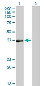 PHYH Antibody in Western Blot (WB)